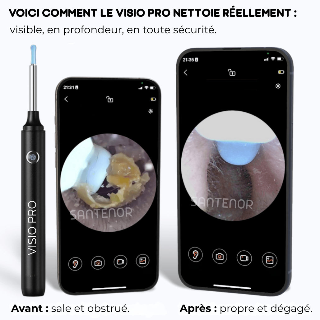 Santenor™ Visio PRO