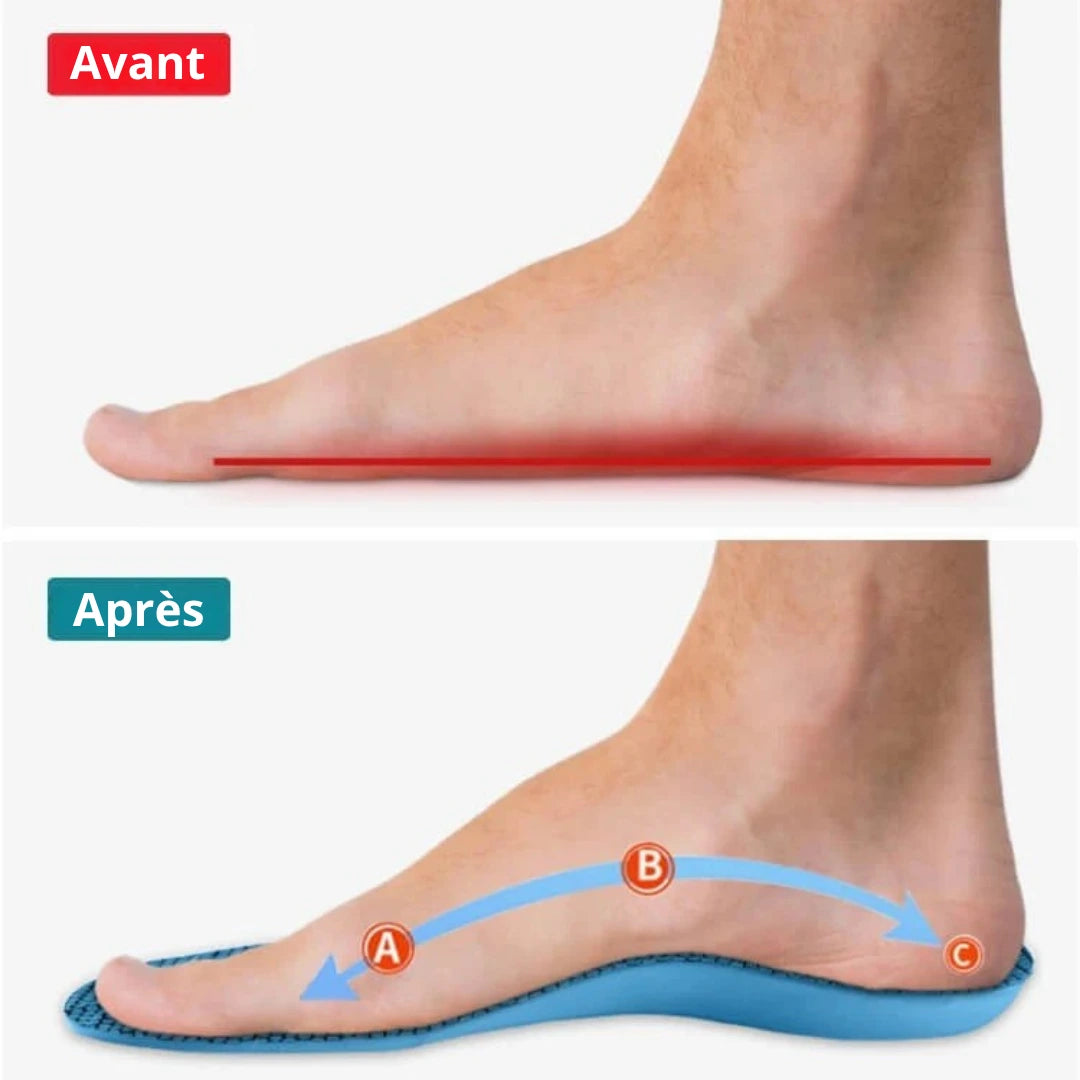 Santenor™ OrthoConfort