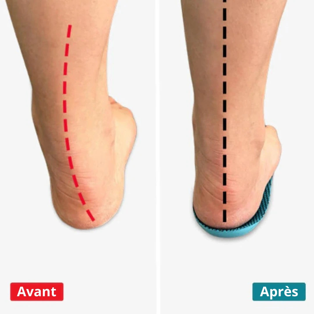 Santenor™ OrthoConfort