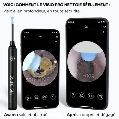 Santenor™ Visio PRO