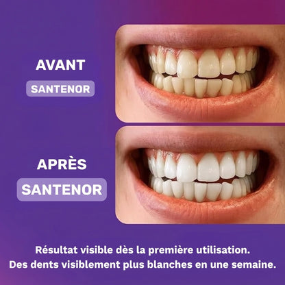 Bandes blanchissantes pour les dents — sans peroxyde