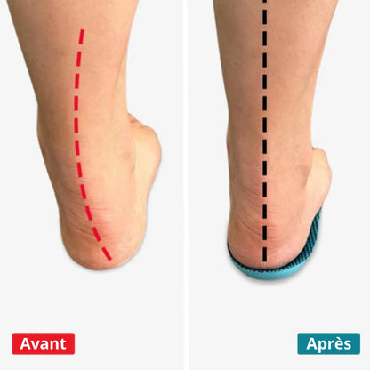 Santenor™ OrthoConfort