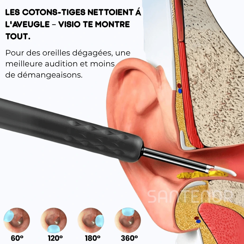 Santenor™ Visio PRO
